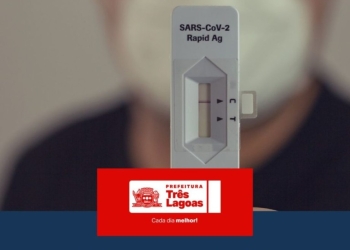 BOLETIM COVID-19 – 29 de abril de 2026