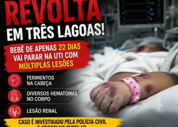 Em Três Lagoas| Bebê de apenas 22 dias vai parar na UTI com ferimentos na cabeça, hematomas e lesão renal