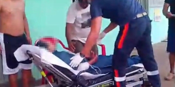 Em Três Lagoas| Homem usa os braços para se proteger de linha com cerol e fica gravemente ferido