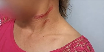 Em Água Clara| Mulher é estrangulada pelo marido e se esconde em casa abandonada para escapar da morte