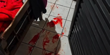 Em Água Clara| Homem é esfaqueado enquanto dormia após discussão por celular